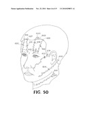 SELF-RETAINING WOUND CLOSURE DEVICE INCLUDING AN ANCHORING LOOP diagram and image