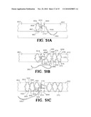 SELF-RETAINING WOUND CLOSURE DEVICE INCLUDING AN ANCHORING LOOP diagram and image