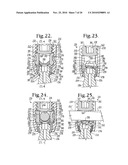 Bone anchors with longitudinal connecting member engaging inserts and closures for fixation and optional angulation diagram and image