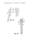 Bone anchors with longitudinal connecting member engaging inserts and closures for fixation and optional angulation diagram and image