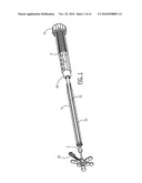 Pelvic Cable Solution diagram and image