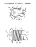 Pelvic Cable Solution diagram and image