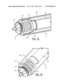 Pelvic Cable Solution diagram and image