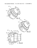 Pelvic Cable Solution diagram and image