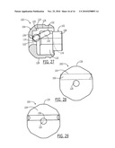 Pelvic Cable Solution diagram and image