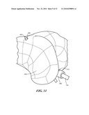 Patient-Specific Joint Arthroplasty Devices for Ligament Repair diagram and image