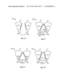 METHODS, SYSTEMS AND DEVICES FOR CARDIAC VALVE REPAIR diagram and image