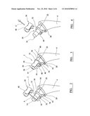 ORTHOPAEDIC JOINT PROSTHESIS IMPLANT KIT diagram and image