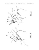 ORTHOPAEDIC JOINT PROSTHESIS IMPLANT KIT diagram and image