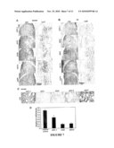 Reversible siRNA-Based Silencing of Mutant and Endogenous Wild-Type Huntingtin Gene and its Application for the Treatment of Huntington s Disease diagram and image