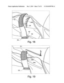 GARMENT HAVING ROLL-UP AND STOW SLEEVES diagram and image