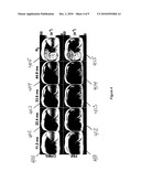 SYSTEM, METHOD AND COMPUTER-ACCESSIBLE MEDIUM FOR PROVIDING BREATH-HOLD MULTI-ECHO FAST SPIN-ECHO PULSE SEQUENCE FOR ACCURATE R2 MEASUREMENT diagram and image