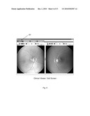 METHOD AND SYSTEM FOR RETINAL HEALTH MANAGEMENT diagram and image