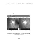 METHOD AND SYSTEM FOR RETINAL HEALTH MANAGEMENT diagram and image
