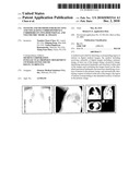 SYSTEMS AND METHODS FOR DETECTING AND VISUALIZING CORRESPONDENCE CORRIDORS ON TWO-DIMENSIONAL AND VOLUMETRIC MEDICAL IMAGES diagram and image