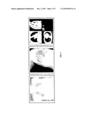 SYSTEMS AND METHODS FOR DETECTING AND VISUALIZING CORRESPONDENCE CORRIDORS ON TWO-DIMENSIONAL AND VOLUMETRIC MEDICAL IMAGES diagram and image