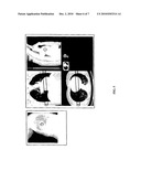 SYSTEMS AND METHODS FOR DETECTING AND VISUALIZING CORRESPONDENCE CORRIDORS ON TWO-DIMENSIONAL AND VOLUMETRIC MEDICAL IMAGES diagram and image