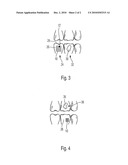 Dental Color Analyzing Device and Methof of Use diagram and image