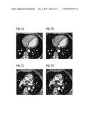 CT IMAGE RECONSTRUCTION OF A MOVING EXAMINATION OBJECT diagram and image