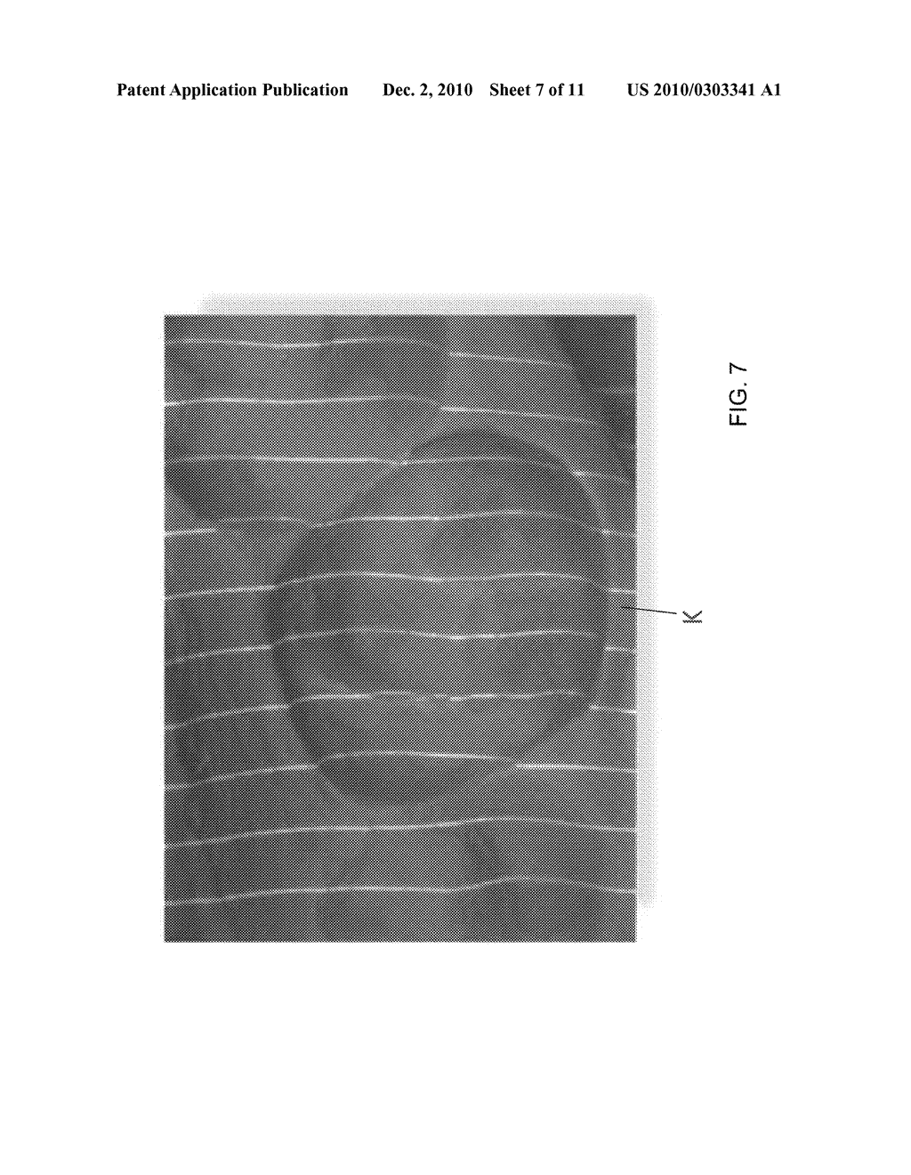 METHOD AND DEVICE FOR THREE-DIMENSIONAL SURFACE DETECTION WITH A DYNAMIC REFERENCE FRAME - diagram, schematic, and image 08
