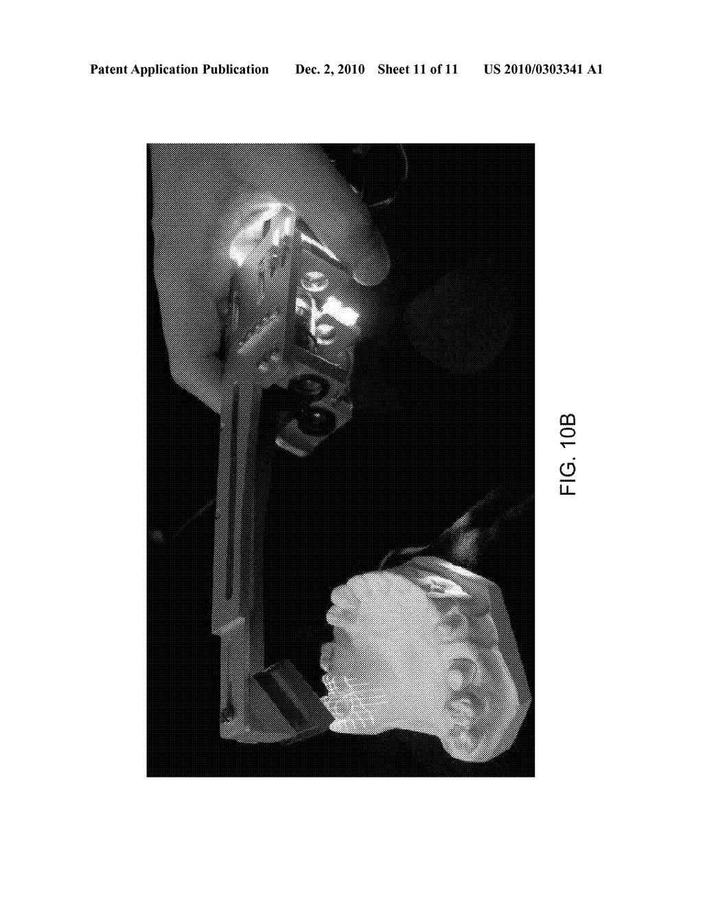 METHOD AND DEVICE FOR THREE-DIMENSIONAL SURFACE DETECTION WITH A DYNAMIC REFERENCE FRAME - diagram, schematic, and image 12