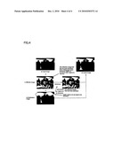 DIGITAL IMAGE PROCESSING AND ENHANCING SYSTEM AND METHOD WITH FUNCTION OF REMOVING NOISE diagram and image