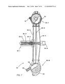 METHODS OF USING REGENERATIVE CELLS IN THE TREATMENT OF MUSCULOSKELETAL DISORDERS diagram and image