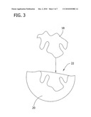 Medical Devices for Localized Drug Delivery diagram and image