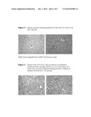 5BETA, 14BETA-ANDROSTANE DERIVATIVES USEFUL FOR THE TREATMENT OF RESTENOSIS AFTER ANGIOPLASTIC OR ENDOARTHERECTOMY AND DISEASES DUE TO ORGAN FIBROSIS diagram and image