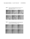 5BETA, 14BETA-ANDROSTANE DERIVATIVES USEFUL FOR THE TREATMENT OF RESTENOSIS AFTER ANGIOPLASTIC OR ENDOARTHERECTOMY AND DISEASES DUE TO ORGAN FIBROSIS diagram and image