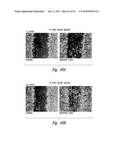 COMPOSITIONS AND METHODS FOR TREATING ASTHMA AND OTHER LUNG DISORDERS diagram and image