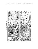 BIOMARKERS FOR PRENATAL DIAGNOSIS OF CONGENITAL CYTOMEGALOVIRUS diagram and image