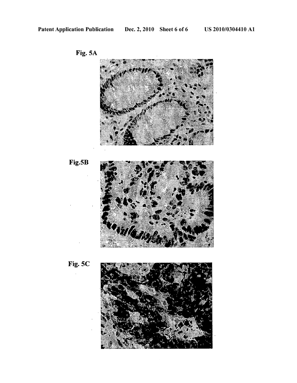 METHOD OF ASSESSING COLORECTAL CANCER STATUS IN AN INDIVIDUAL - diagram, schematic, and image 07