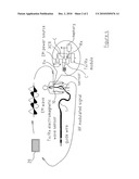 GUIDEWIRE SENSOR DEVICE AND SYSTEM diagram and image