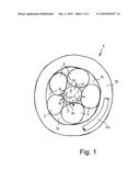 Controllable stiffness catheter guide device diagram and image