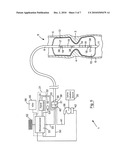  METHOD AND APPARATUS FOR DETERMINING THE DISTENSIBILITY OF A VESSEL, LUMEN OR A SPHINCTER diagram and image