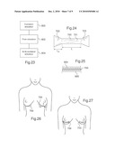 USES OF ELECTROACTIVE MATERIAL ACTUATORS IN COSMETICS diagram and image