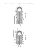 VOLTAGE THRESHOLD ABLATION APPARATUS diagram and image