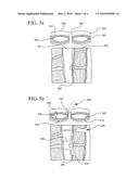 INCISION CLOSURE DEVICE AND METHOD diagram and image