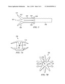 Transpyloric Anchoring diagram and image