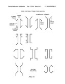 Transpyloric Anchoring diagram and image