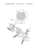 MULTIDIRECTIONAL BONE FIXATION ASSEMBLY diagram and image