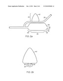 Conical Balloon for Deployment Into Side Branch diagram and image