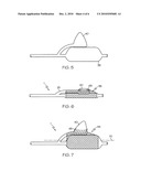 Conical Balloon for Deployment Into Side Branch diagram and image