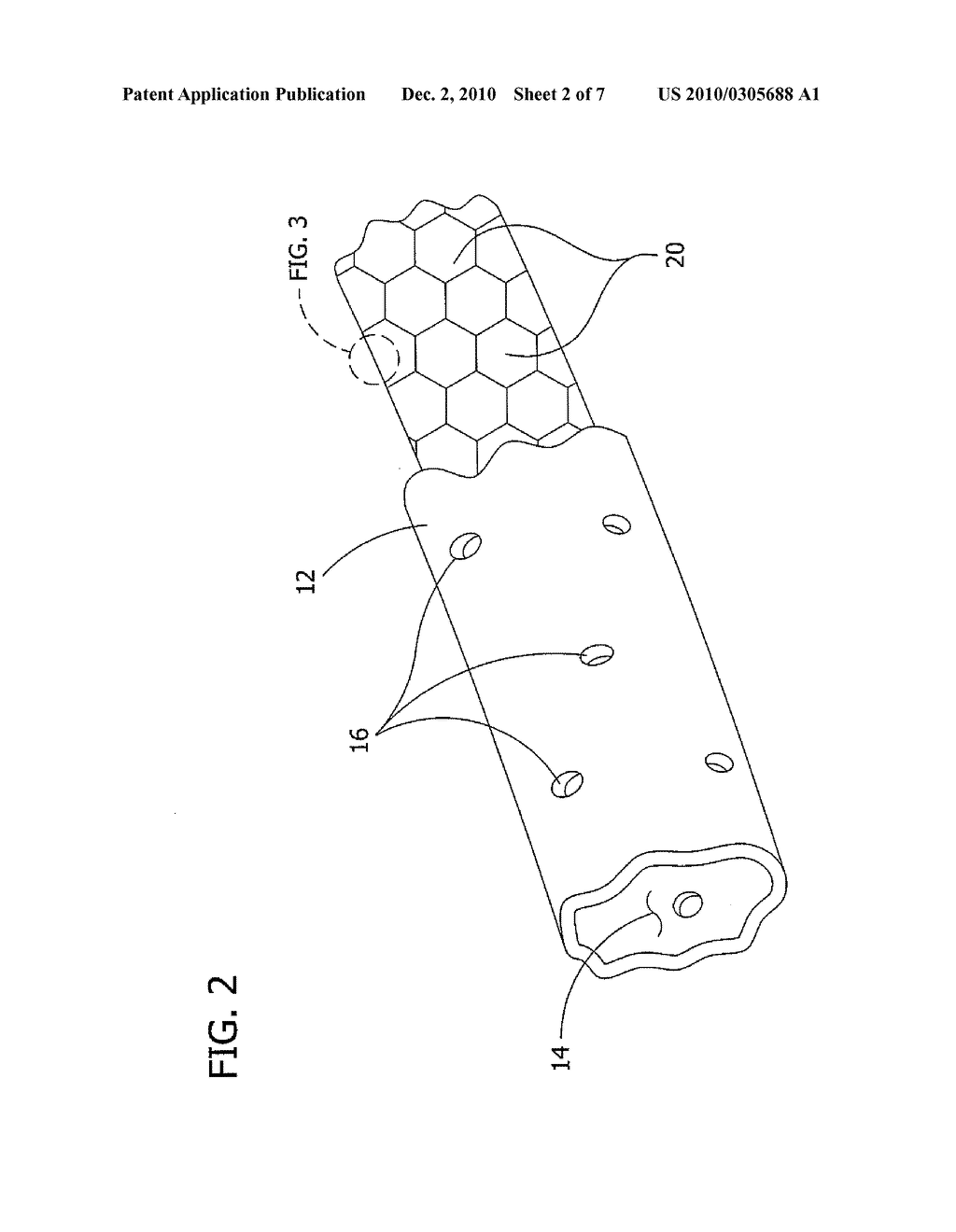 Medical Devices for Localized Drug Delivery - diagram, schematic, and image 03