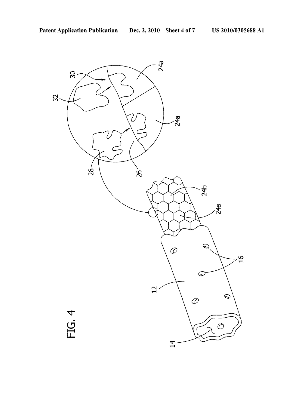 Medical Devices for Localized Drug Delivery - diagram, schematic, and image 05