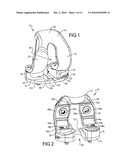 Knee Prosthesis Assembly With Ligament Link diagram and image