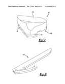 Knee Prosthesis diagram and image