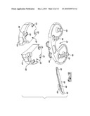 Knee Prosthesis diagram and image