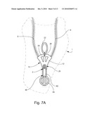 DEVICE FOR OPENING AND CLOSING A ZIPPER diagram and image